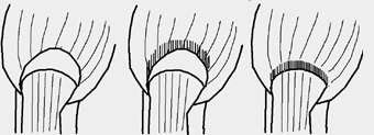 ligules